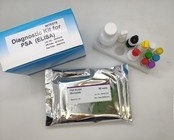 Antigène Elisa Home Test Kit de noyau de virus de l'hépatite B 96 morceaux de rendement élevé