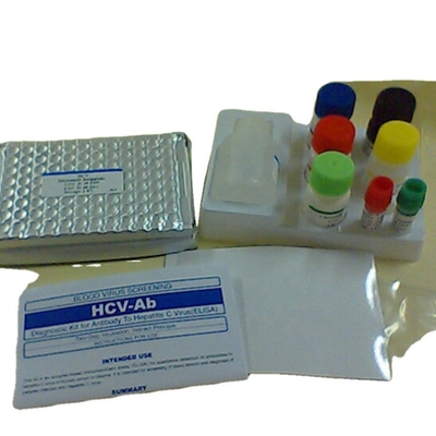 Interleukin 1 bêta kit Il1b humain Elisa Kit Reaserch Use de détection d'elisa